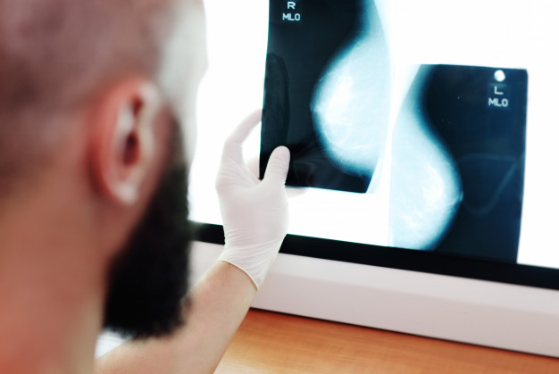 mamografia - Outubro Rosa: Como prevenir e de que forma se engajar?